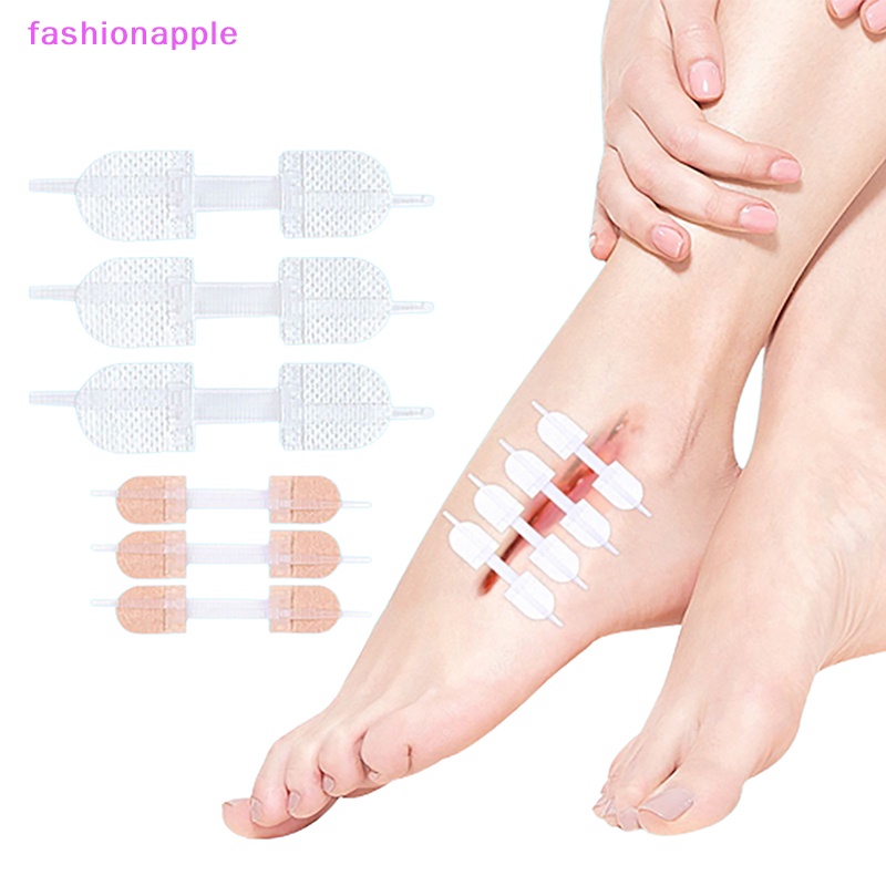 Favn Băng Dính Có Dây Kéo Chống Tĩnh Điện Vá Vết Thương Nhanh Chóng