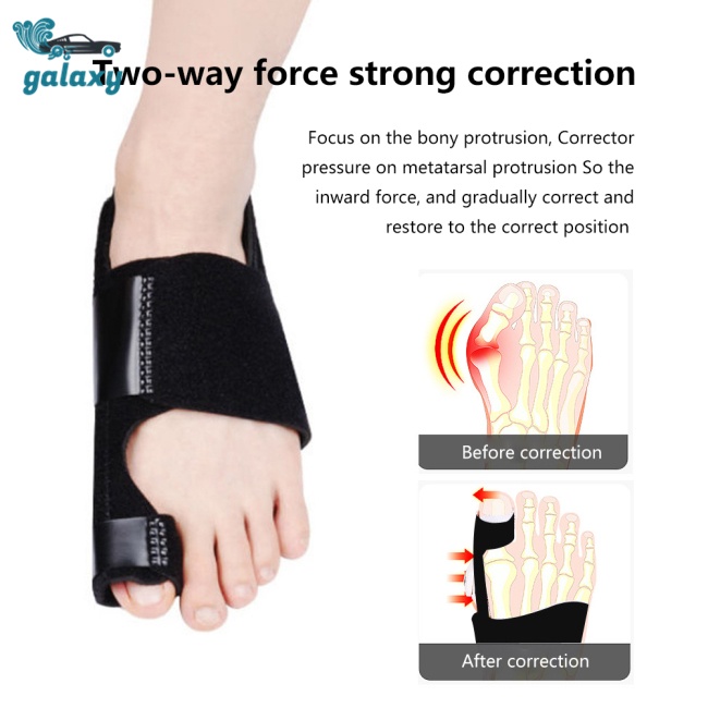 Galaxy 1 Cặp Dụng Cụ Chỉnh Hình Ngón Chân Cái