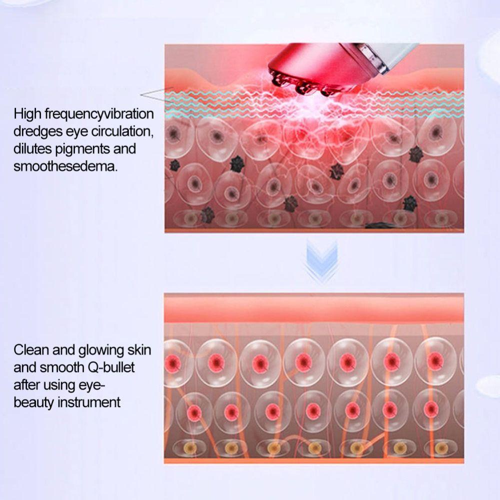 Máy Massage Nhiệt Điện EMS Chăm Sóc Da Mặt|Tinh Chất Hỗ Trợ Làm Giảm Quầng Thâm Và Cải Thiện Tần Số Radio RF