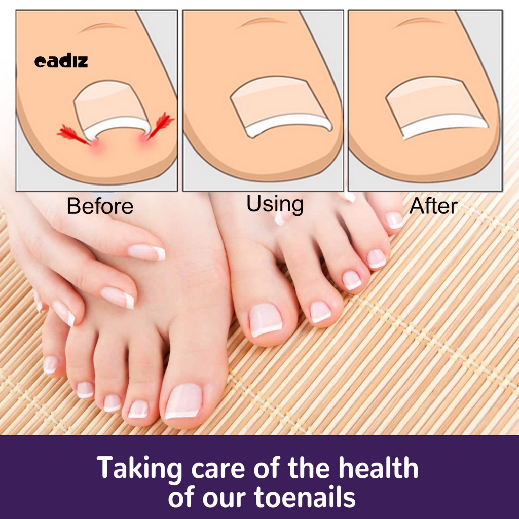 Bộ 50 Miếng Dán Móng Chân Thoáng Khí Hình Bướm Cho Nam