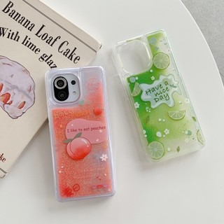 Ốp Điện Thoại Mềm Phối Kim Tuyến Nước Cho Xiaomi 13 12 12S 12T Pro 12X Xiaomi Mi 11 Lite Mi 10 Lite Mi 10 9 8