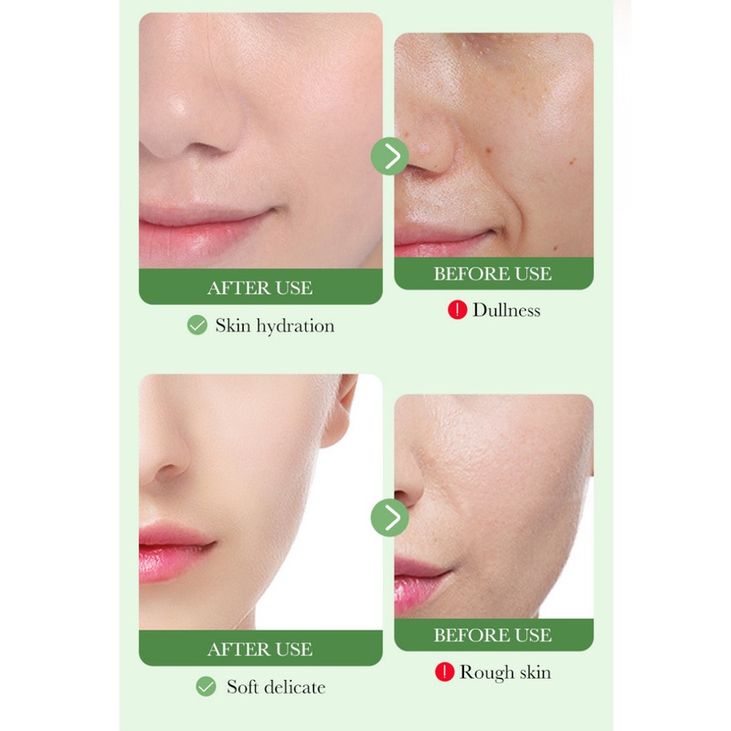 Kem Dưỡng Da Mặt BIOAOUA Centella Asiatica Làm Dịu Da 50g