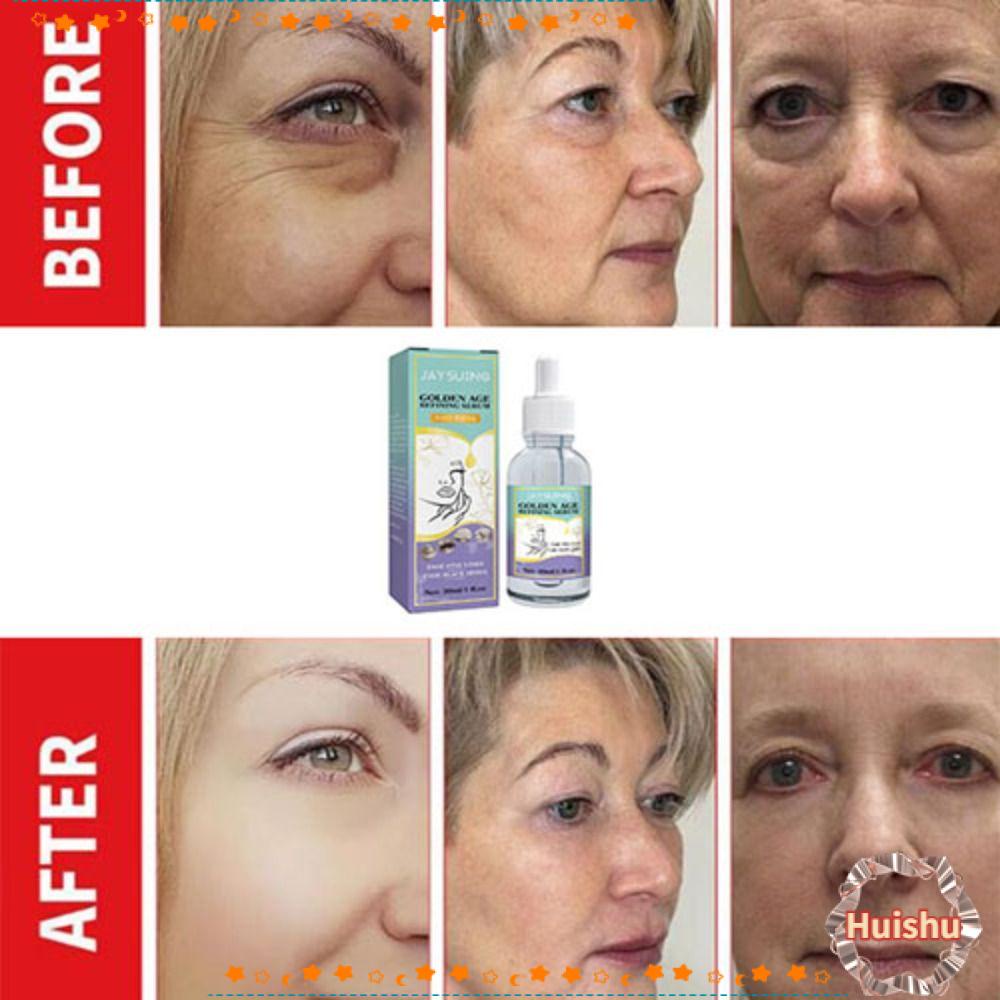 Serum Chống Nếp Nhăn Làm Trắng Da Dành Cho Nữ