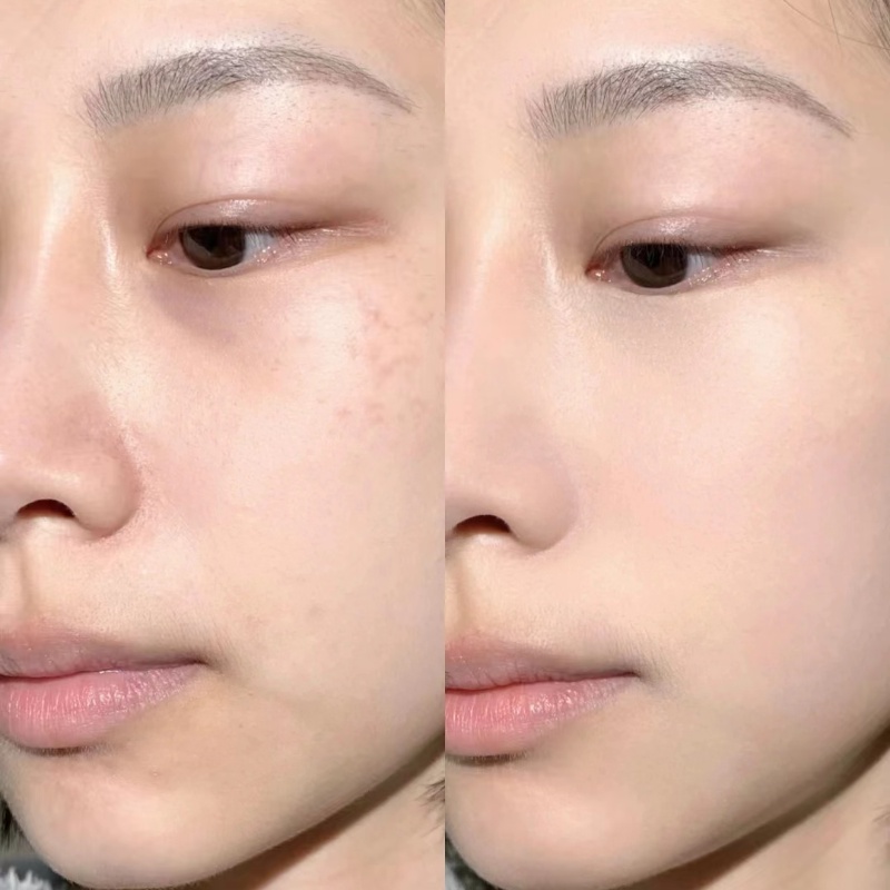 Kem Che Khuyết Điểm Judydoll Năm Màu Độ Bóng Cao Che Phủ Mụn Và Quầng Thâm Mắt