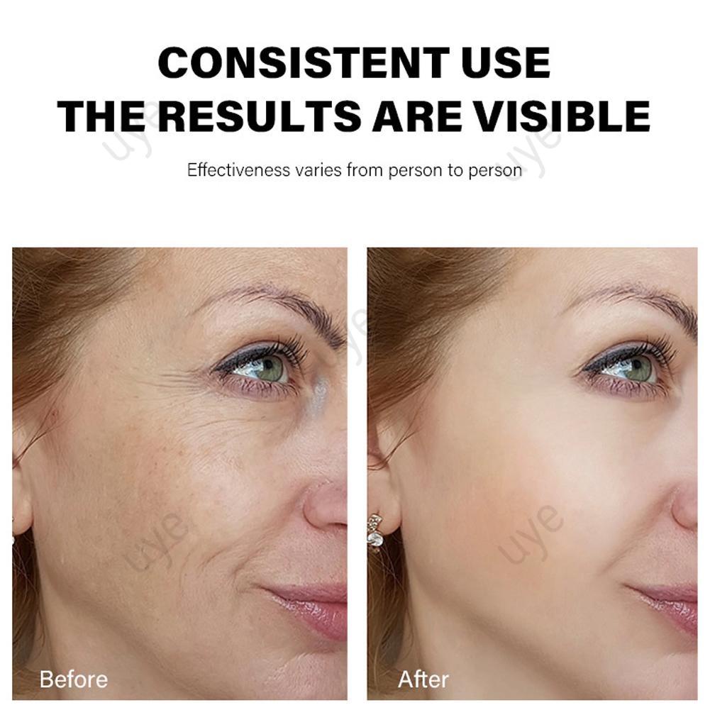 Kem Dưỡng Da Mặt 30g Chứa Retinol Chống Lão Hóa Xóa Mờ Nếp Nhăn Làm Săn Chắc Da