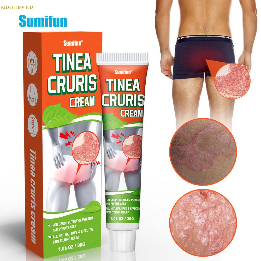 【Thanh Toán Khi Nhận Hàng】 30G Kem Sumifun Tinea Cruris Sửa Chữa Da Ban Đỏ Vùng Kín Quanh Hậu Môn Mỡ Thảo Dược Tự Nhiên Kháng Khuẩn Chống Ngứa Chăm Sóc Cơ Thể