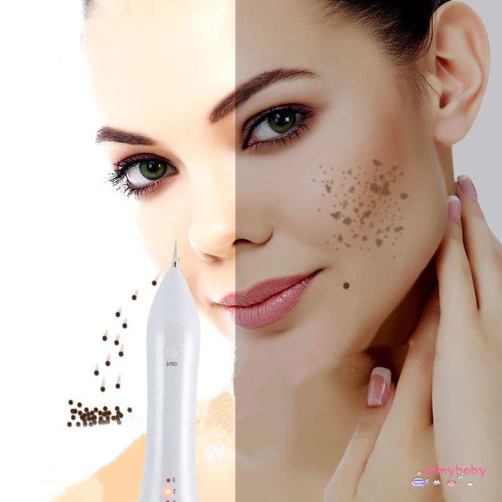 [InStock] Portable Electric Age Spot Pen Forts Máy xóa sẹo tàn nhang Thiết bị làm đẹp [Z/13]