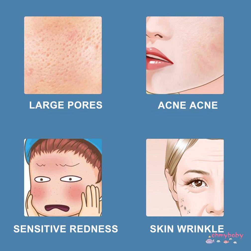 [OMB] Mini 25Ml Mặt Hơi Nước Tạo Độ Ẩm Máy Phun Sương Làm Đẹp Dụng Cụ Nano Mist USB Cho Cá Nhân Bảo Vệ Chăm Sóc Da [Z/10]