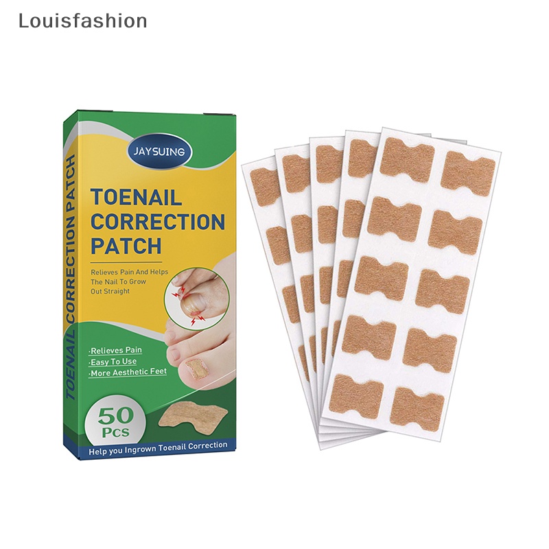 Bộ 50 Miếng Dán Chỉnh Sửa Móng Chân Cái Louisfashion