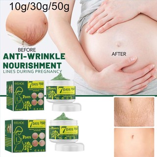 50g kem Hỗ trợ giảm sẹo da kem Hỗ trợ giảm rạn da sẹo mỡ kem điều trị vết rạn da