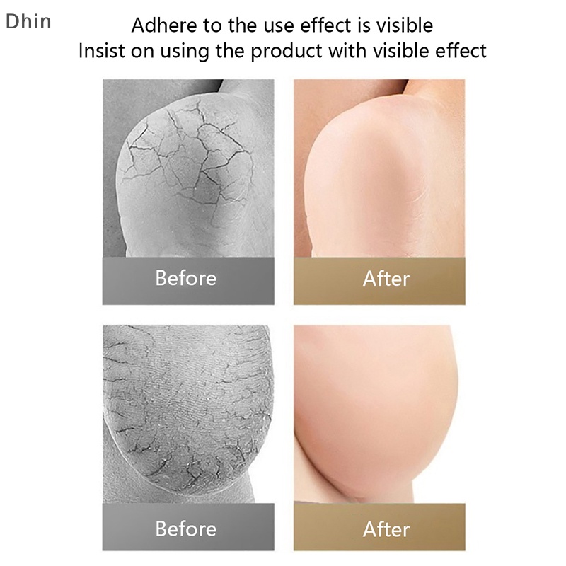 1 Cặp Đệm Silicone Gel Dán Gót Chân Tiện Dụng