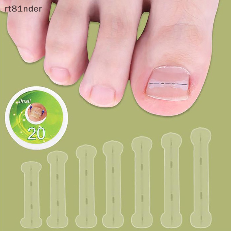 Set 10 Dụng Cụ Hỗ Trợ Chỉnh Hình Móng Chân Mọc Ngược