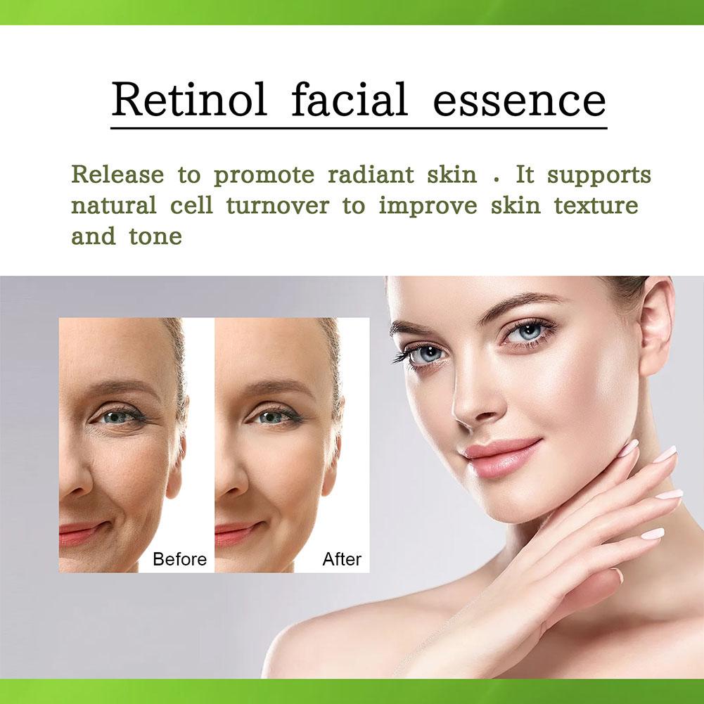Tinh Chất Retinol OUHOE 10ml Dưỡng Ẩm Làm Sáng Da O5H0