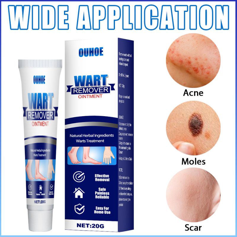 ⚡⚡COD Ouhoe Kem Tẩy Mụn Cóc Thuốc Mỡ Kháng Khuẩn Điều Trị Nốt Ruồi Thẻ Da Huyết Thanh Thạch Cao Bắp Chân Chiết Xuất Thảo Dược An Toàn Không Đau Hiệu Quả Để Chăm Sóc Cơ Thể