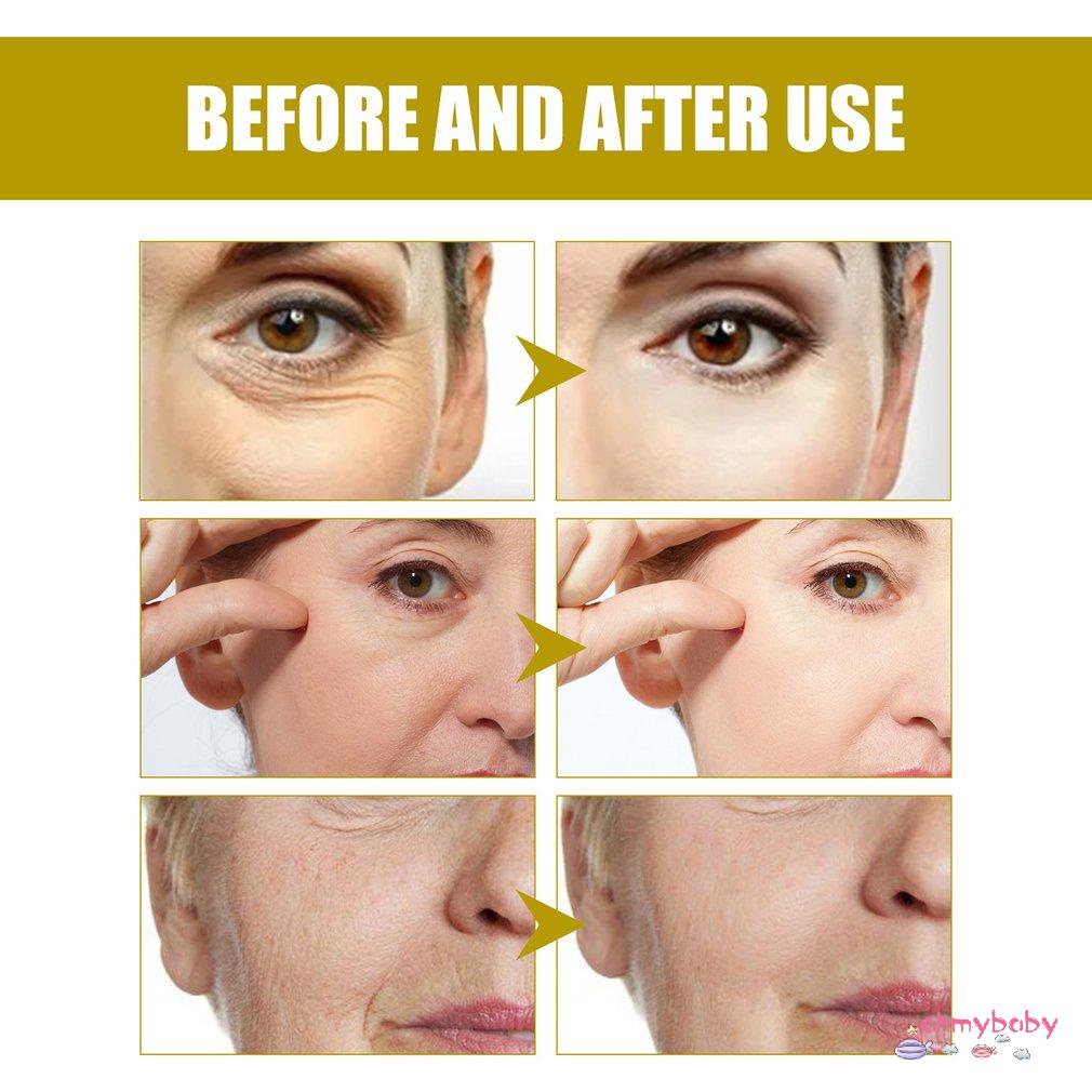 [InStock] 50G Kem Dưỡng Da Tức Thì Chống Nhăn Axit Hyaluronic Ẩm Peptide Tinh Chất Mỹ Phẩm Làm Đẹp [Z/3]