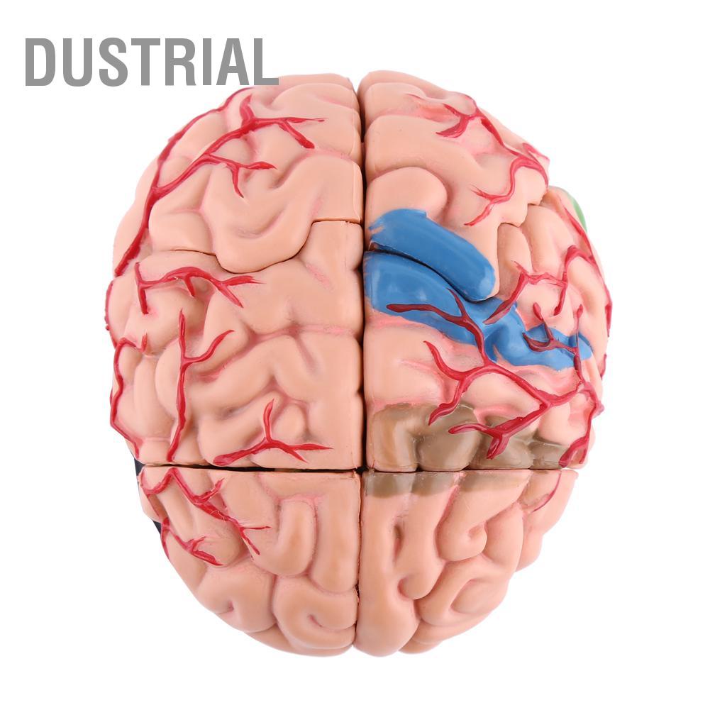 Dustrial 1 Máy Tính Tháo Rời Giải Phẫu Bộ Não Con Người Mô Hình Y Tế Dụng Cụ Giảng Dạy Đồ Chơi