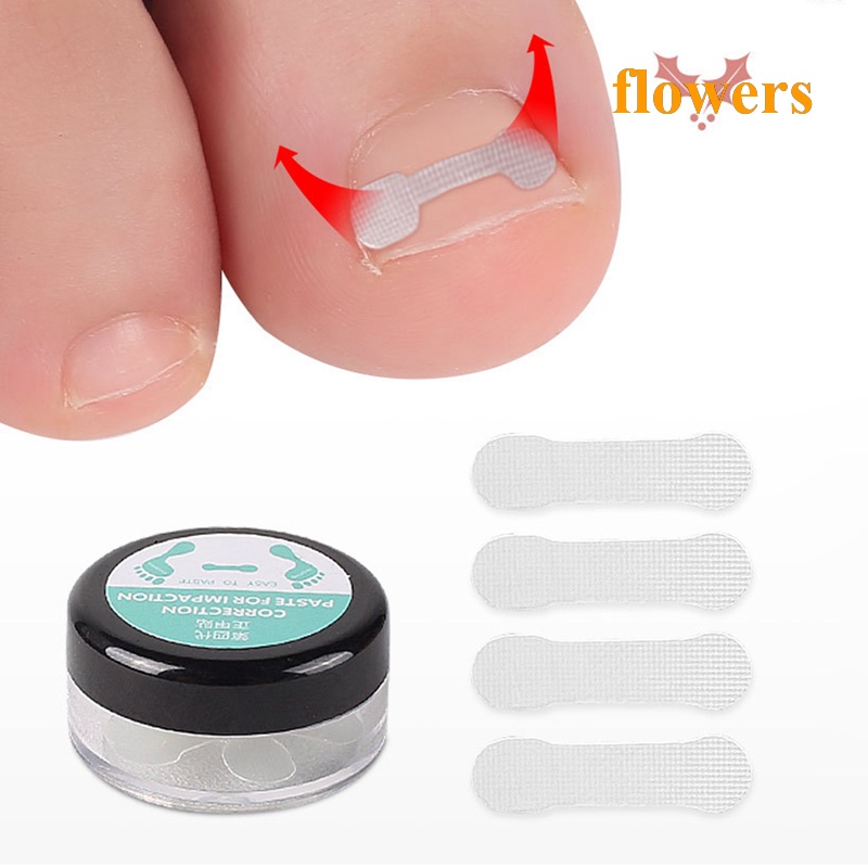 Bộ 10 Miếng Dán Chỉnh Sửa Móng Chân Mọc Nhanh Tiện Lợi