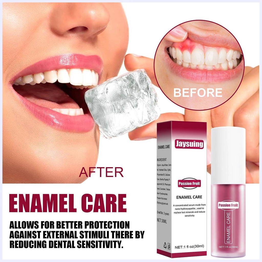 Kem Đánh Răng SMILEKIT / ALIVER / Eelhoe / Hismile Làm Trắng Răng V34 Chống Nhạy Cảm