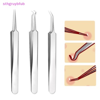 Nhíp Lấy Nhân Mụn Đầu Nhọn Chăm Sóc Da Mặt