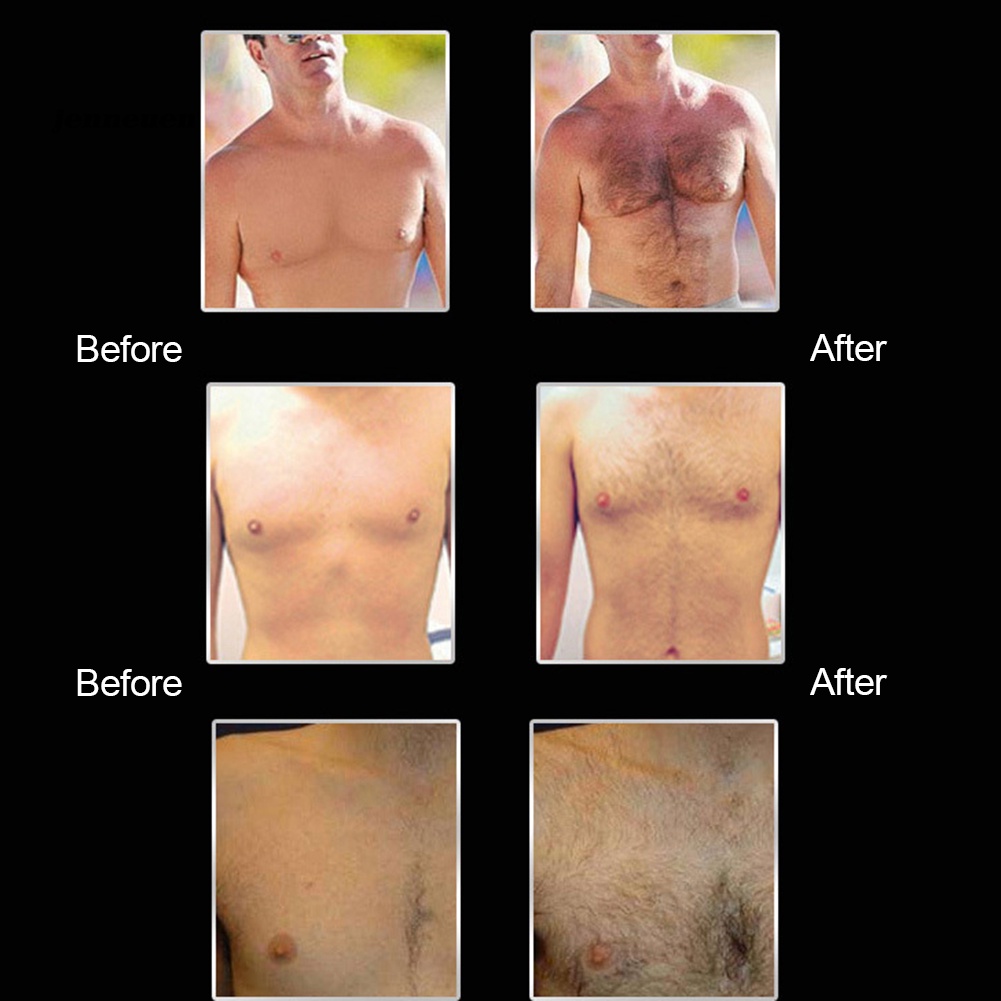 Tinh Dầu Kích Thích Mọc Râu Cho Nam Giới Pei Mei 30ML