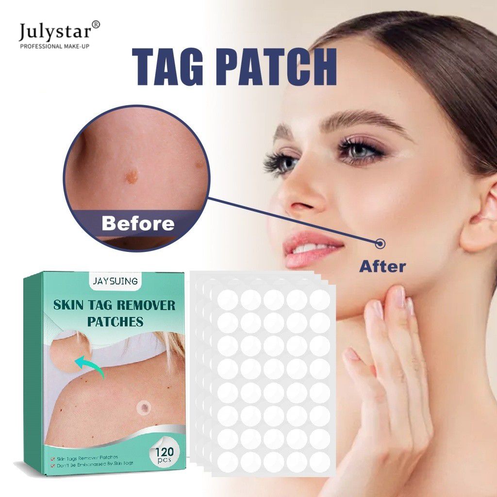120 cái Loại bỏ mụn cóc Thạch cao Mụn trứng cá Miếng dán vô hình Thẻ da Miếng dán điều trị mụn Chiết xuất thảo dược để chăm sóc sắc đẹp trên khuôn mặt JULYSTAR