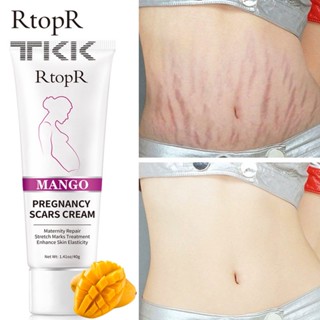  Kem Trị Rạn Da Cho Phụ Nữ Mang Thai Tk373 
