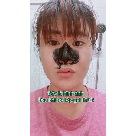 Gel lột mụn than tre kone thái lan