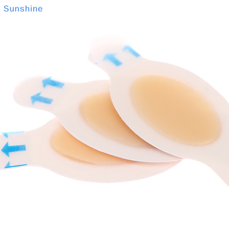 Bộ 4 Miếng Dán Thạch Cao Hydrocolloid Chống Mòn Chăm Sóc Bàn Chân