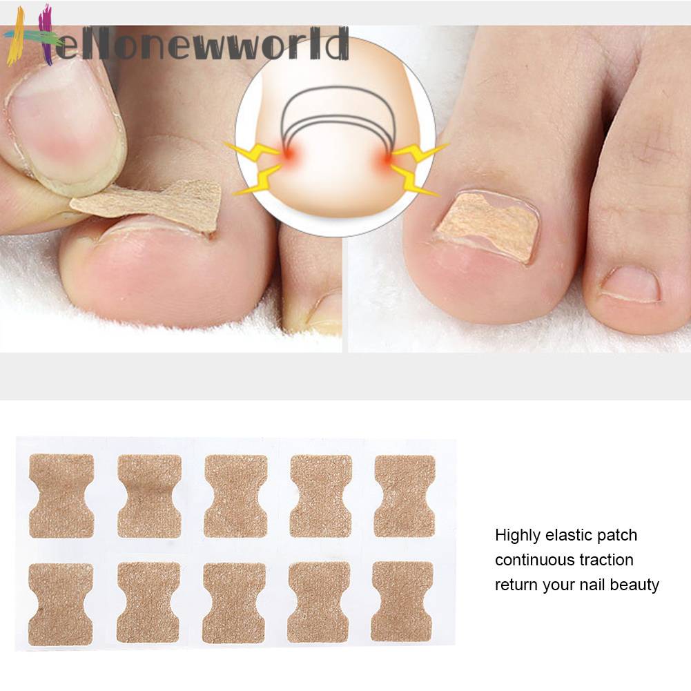 Set 10 Miếng Dán Chỉnh Sửa Móng Chân Tiện Dụng