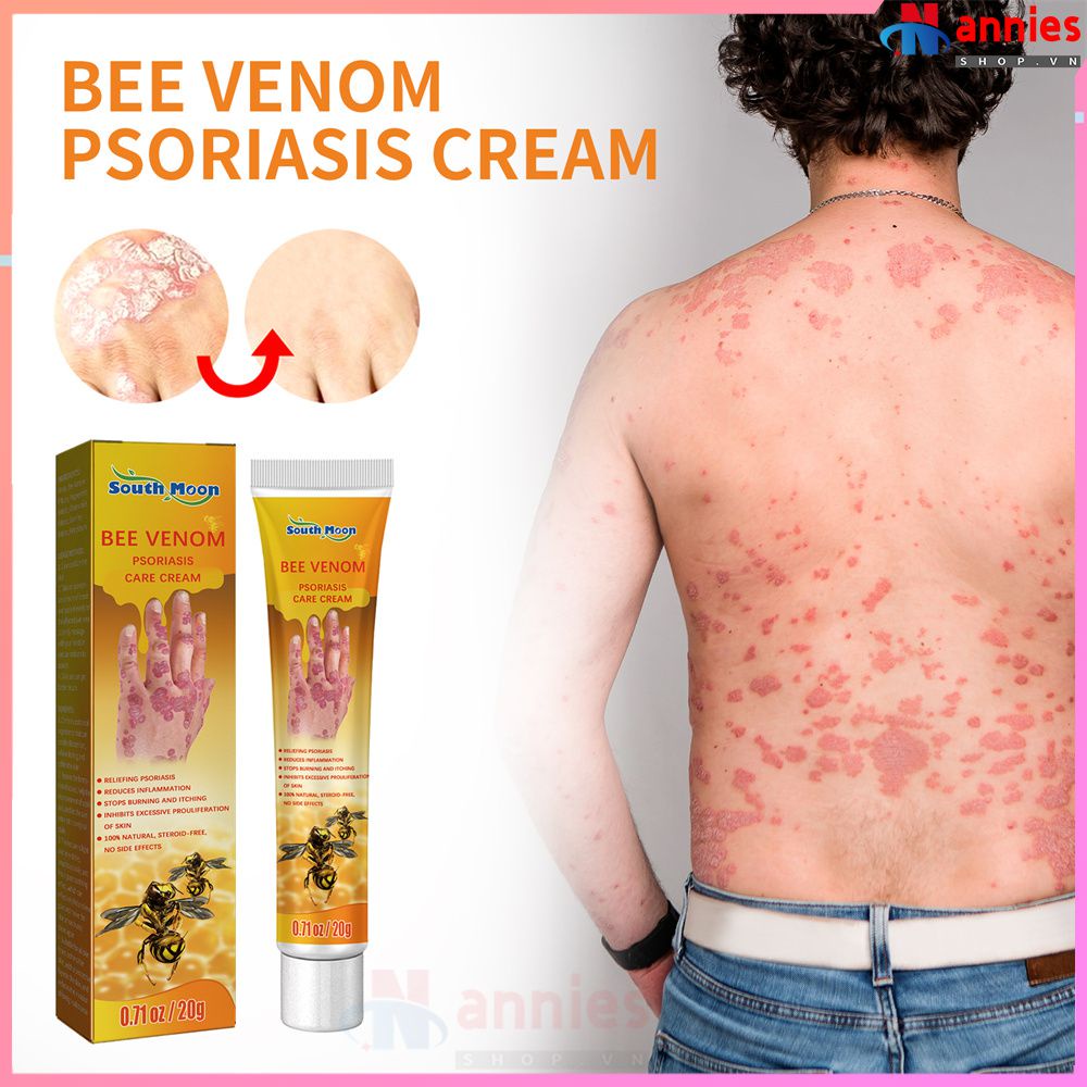 South Moon Herbal Antipruritic Ointment Skin Khó chịu Thuốc mỡ bôi ngoài da trị vẩy nến (annies.shop_vn)