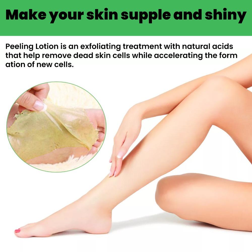 NIUYOU Lotion Dạng Lột Trị Mụn Đầu Đen Làm Trắng Da Và Tẩy Tế Bào Chết Cho Mắt Cá Chân