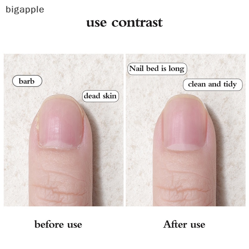 1 Dụng Cụ Loại Bỏ Da Chết Cho Móng Tay Tiện Dụng