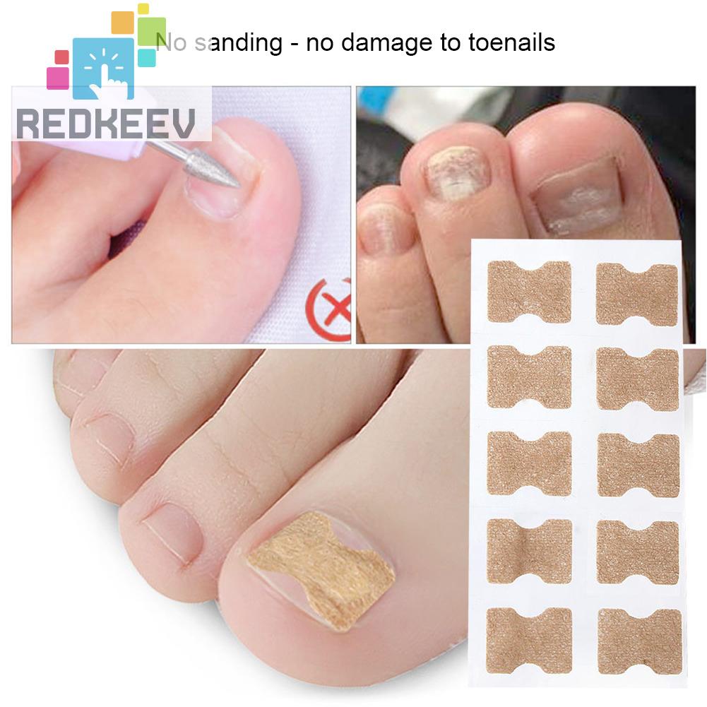 Set 10 Miếng Dán Chỉnh Sửa Móng Chân Tiện Dụng