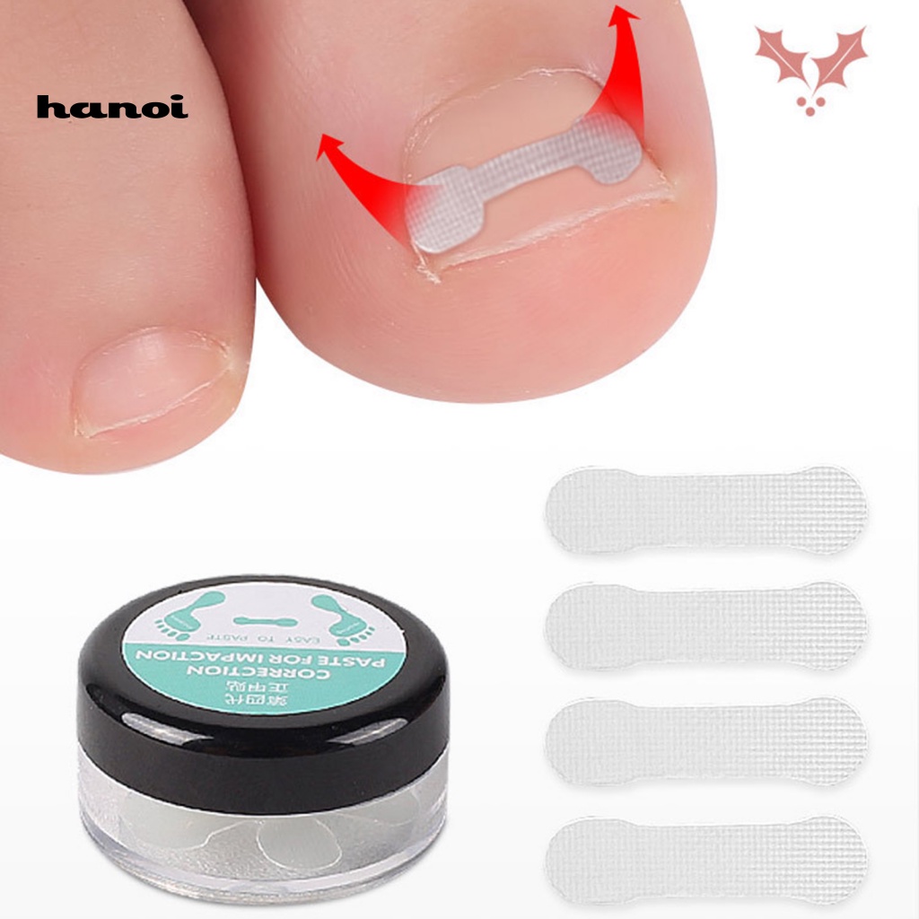 Hộp 10 Miếng Dán Chỉnh Sửa Móng Chân Nhanh Chóng Tiện Lợi