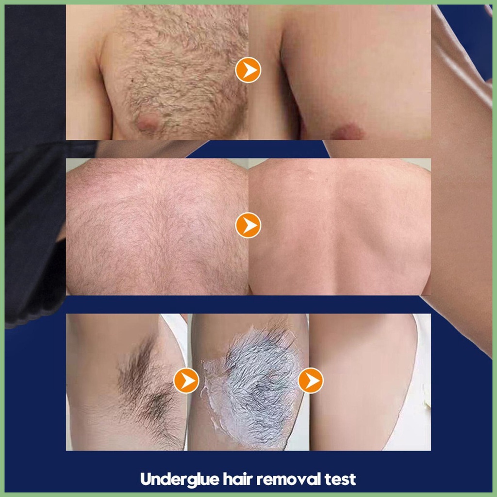 Kem Tẩy Lông Vĩnh Viễn Không Đau Nhanh Chóng Cho Nam Giới Pxu1Vn