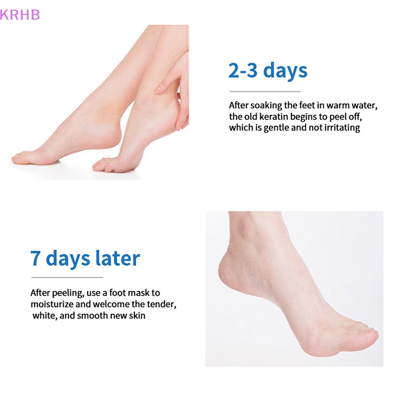 Mặt Nạ Chân Dưỡng Ẩm Tẩy Tế Bào Chết Chống Nứt Nẻ KRHB