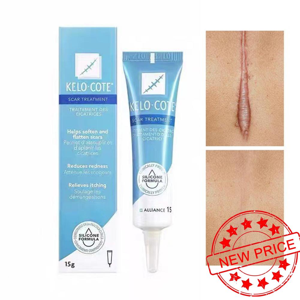Kem Làm Mờ Sẹo 15g Q5Q9 Tiện Dụng Chất Lượng Cao