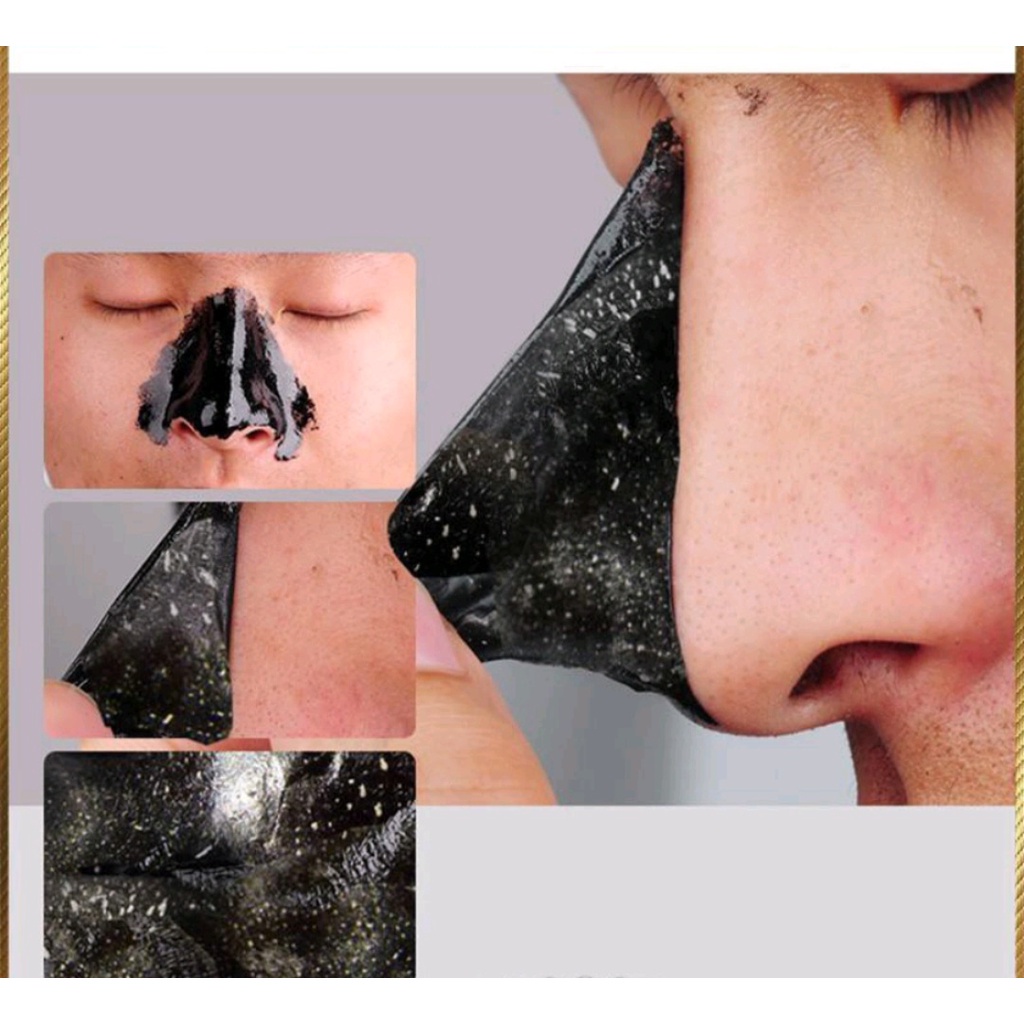 Mặt nạ lột mụn đầu đen mũi ARSE FANS