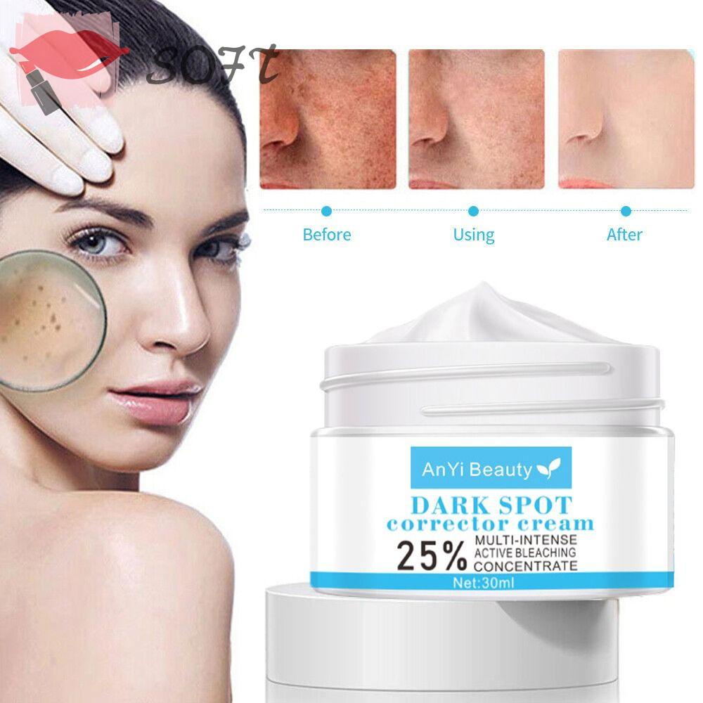 SOFTNESS Kem Làm Trắng Da 30g Loại Bỏ Tàn Nhang Đốm Đen Hiệu Quả