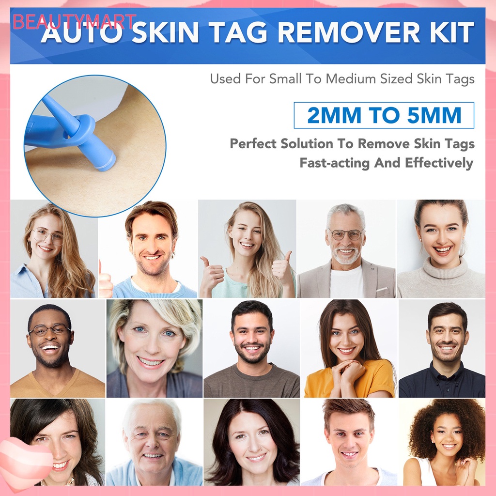 1 Bộ Dụng Cụ Loại Bỏ Mụn Cóc Trên Da Trọng Lượng Nhẹ Nhanh Chóng