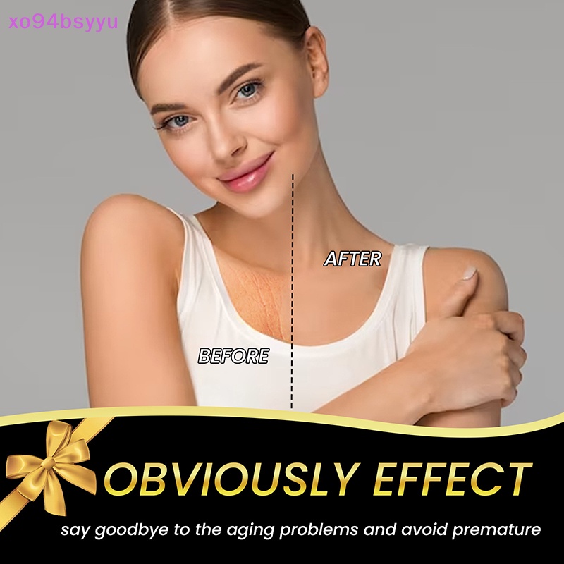 Set 5 Miếng Dán Ngực Xo94Bsyu Bằng Silicon Trong Suốt Dưỡng Ẩm Chống Nếp Nhăn Chống Lão Hóa Có Thể Tái Sử Dụng