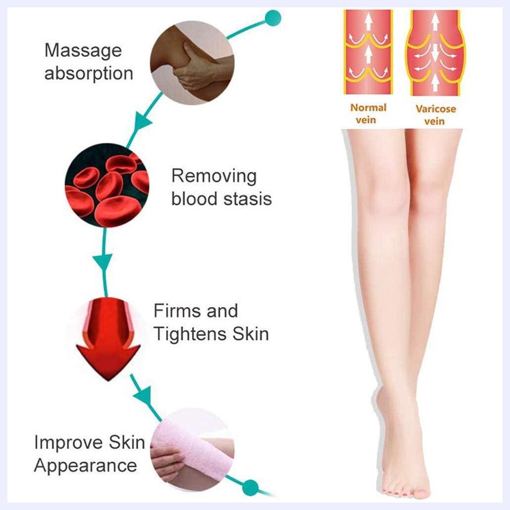 Kem trị suy giãn tĩnh mạch Maikang Cream Leg Care 20g