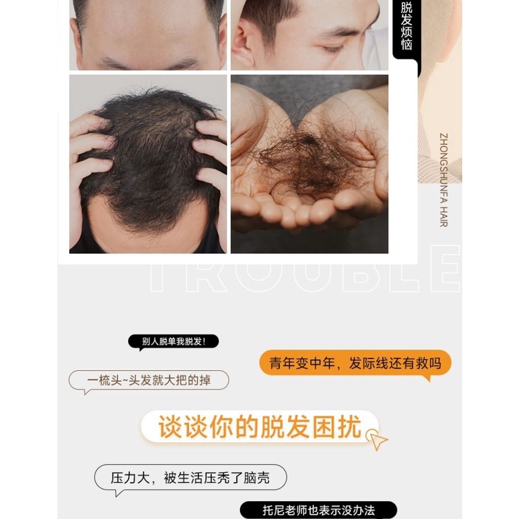 Miếng Dán Giả Tóc Mái Ngang Trán Tự Nhiên Không Đường May Thoáng Khí Cho Nam