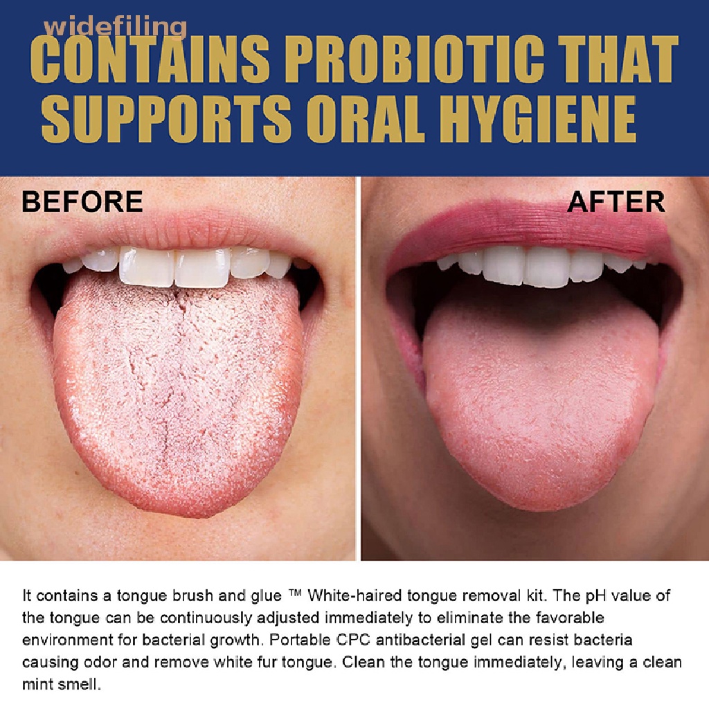 Bộ Gel Làm Sạch Lưỡi Kèm Cọ Chuyên Dụng Cho Người Lớn