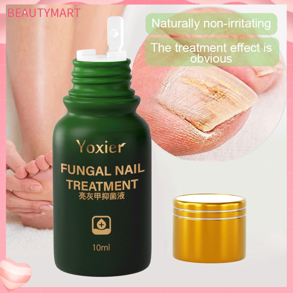 Tinh Chất Hỗ Trợ Giảm Nấm Móng Chống Nhiễm Trùng Hiệu Quả 10ml