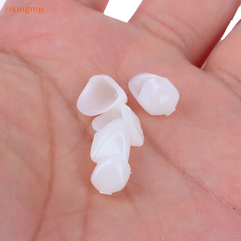 [risingmp] 1 Hộp Vật Liệu Sứ Hình Vương Miện Đỗ Xe Tạm Thời Răng Trước Chỉ Sử Dụng Răng Cho Mô Hình Răng
