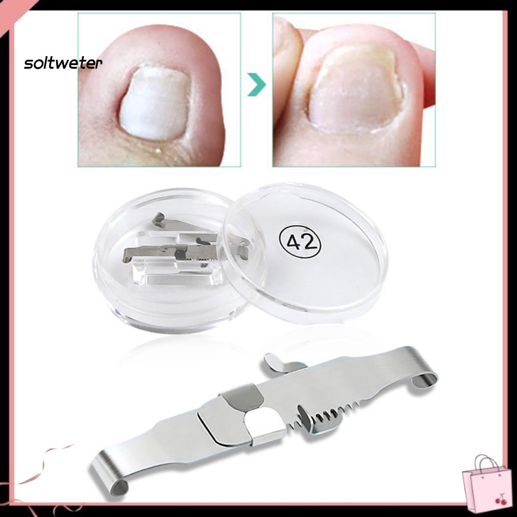 Dụng Cụ Nâng Chỉnh Sửa Móng Chân Mọc Ngược Bằng Thép Không Gỉ Chuyên Nghiệp