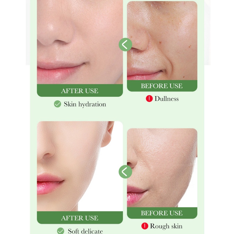 Bioaoua centella Asiatica Facial Moisturizer lotion dưỡng ẩm cho da khô da nhạy cảm có sẵn 80ml