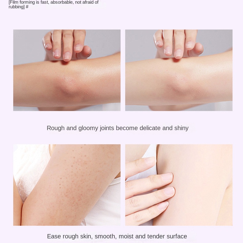 Lotion Nicotinamide Dưỡng Ẩm Làm Trắng Da Tẩy Tế Bào Chết