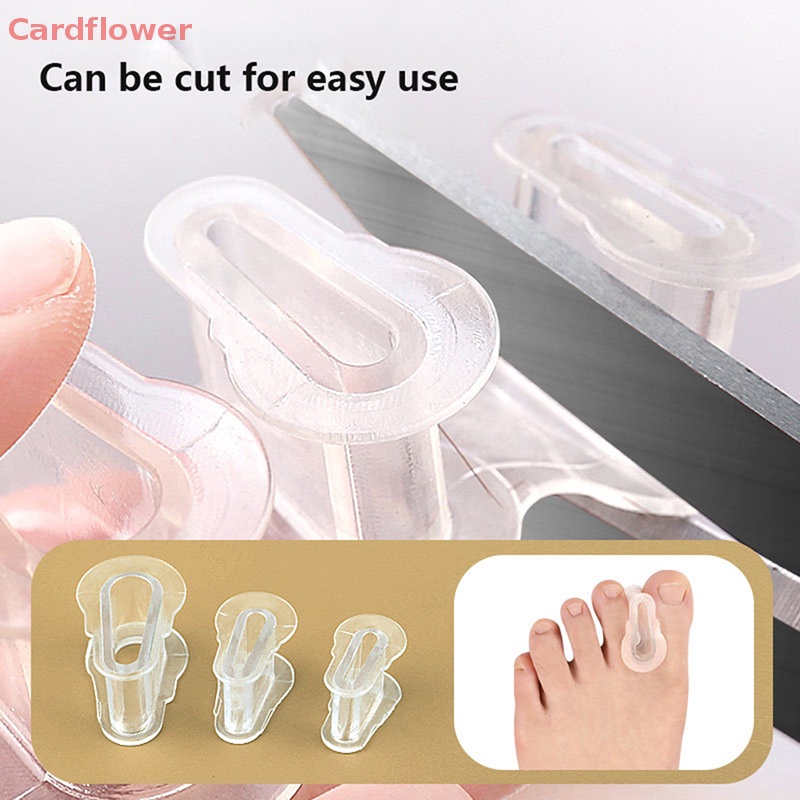 1 Dụng Cụ Tách Ngón Chân Cái Bằng Silicon Mới